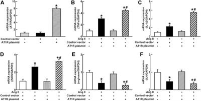 Myeloid Angiotensin II Type 1 Receptor Mediates Macrophage Polarization and Promotes Vascular Injury in DOCA/Salt Hypertensive Mice